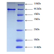 SDS-PAGE analysis of Mouse Serum Albumin Protein.