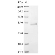 Discontinuous SDS-PAGE (reduced) analysis with 5% enrichment gel and 15% separation gel, using Tris-glycine gel.