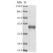 SDS-PAGE analysis of Human ASGR1 Protein (Tris-glycine gel, with 5% enrichment gel and 15% separation gel).