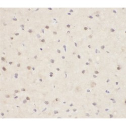 Beta-Amyloid Precursor Protein (APP) Antibody