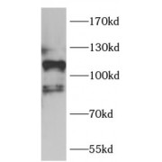 WB analysis of 293T cells, using Aβ42 antibody (1/1000 dilution).