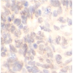 Caveolin 1 (CAV1) Antibody