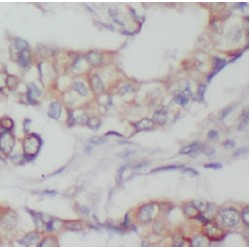 FYN Oncogene Related To SRC, FGR, YES (FYN) Antibody