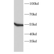 WB analysis of HeLa cells, using FYN antibody (1/1000 dilution).