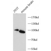WB analysis of various lysates, using FGFR3 antibody (1/1000 dilution).