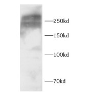 WB analysis of U-87MG cells, using FN1 antibody (1/1000 dilution).