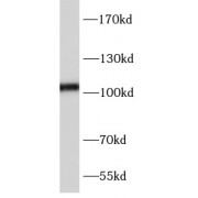 WB analysis of BT-474 cells, using GRIA1 antibody (1/1000 dilution).