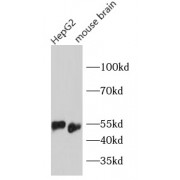 WB analysis of various lysates, using SOX9 antibody (1/1000 dilution).