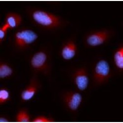 Survivin (BIRC5) Antibody