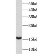 WB analysis of HeLa cells, using Survivin antibody (1/1000 dilution).