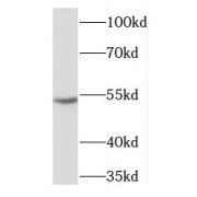 WB analysis of HeLa cells, using XIAP antibody (1/1000 dilution).