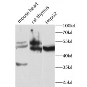 WB analysis of various lysates, using FGFR1 antibody (1/1000 dilution).
