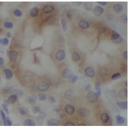 protein Tyrosine Phosphatase 1B (PTP1B) Antibody