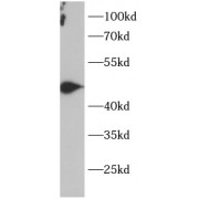 WB analysis of jurkat cells, using PTP1B antibody (1/1000 dilution).