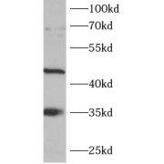 WB analysis of HepG2 cells, using SCF antibody (1/1000 dilution).