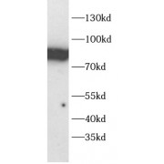 WB analysis of Jurkat cell lysates, using PIK3R1 antibody (1/1000 dilution).
