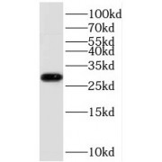 WB analysis of Mcf-7 cells, using TOLLIP antibody (1/1000 dilution).