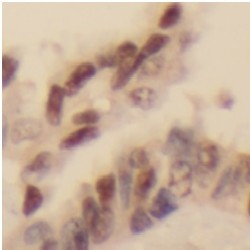 Dual Specificity Mitogen-Activated Protein Kinase Kinase 7 (MKK7) Antibody