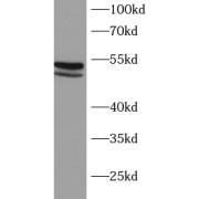 WB analysis of HeLa cells, using MKK7 antibody (1/1000 dilution).