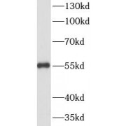 WB analysis of HeLa cells, using VIM antibody (1/1000 dilution).