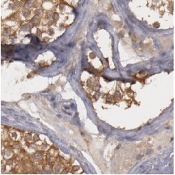 Epithelial Discoidin Domain-Containing Receptor 1 (DDR1) Antibody