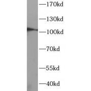 WB analysis of U87MG cells, using DDR1 antibody (1/1000 dilution).