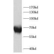 WB analysis of HeLa cells, using FSHR antibody (1/1000 dilution).