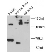 WB analysis of various cell lysates, using IL-16 antibody (1/1000 dilution).