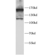 WB analysis of HeLa cells, using MSH6 antibody (1/1000 dilution).