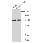 WB analysis of various lysates, using MYD88 antibody (1/1000 dilution).