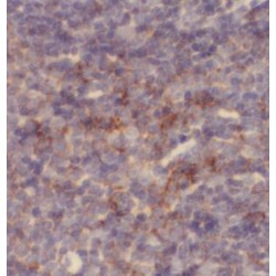 Toll Like Receptor 2 (TLR2) Antibody