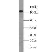 WB analysis of Rat spleen tissue, using TLR2 antibody (1/1000 dilution).