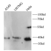 WB analysis of various lysates, using CXCR4 antibody (1/1000 dilution).