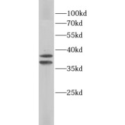 WB analysis of Jurkat cells, using PRKAG1 antibody (1/1000 dilution).