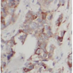 Arylamine N-Acetyltransferase 1 (NAT1) Antibody