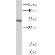 WB analysis of HeLa cells, using NAT1 antibody (1/500 dilution).