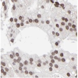 N-Methylpurine DNA Glycosylase (MPG) Antibody