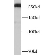 WB analysis of BT474 cells, using ABCA4 antibody (1/1000 dilution).