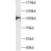 WB analysis of rat skeletal muscle tissue, using ACTN3 antibody (1/1000 dilution).