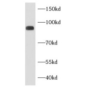 WB analysis of A549 cells, using ADAM10 antibody (1/500 dilution).