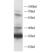 WB analysis of A549 cells, using ADAM28 antibody (1/800 dilution).