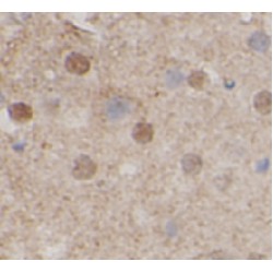 ADP-Ribosylation Factor GTPase Activating Protein 1 (ARFGAP1) Antibody