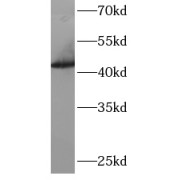 WB analysis of HeLa cells, using ARFGAP1 antibody (1/1000 dilution).