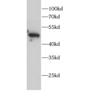 WB analysis of Mouse brain, using AP2M1 antibody (1/1000 dilution).