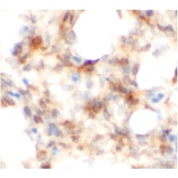 Amphiregulin (AREG) Antibody