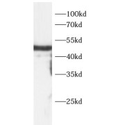 WB analysis of MCF-7 cells, using AREG antibody (1/600 dilution).