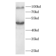 WB analysis of MCF-7 cells, using ATF6 antibody (1/1000 dilution).