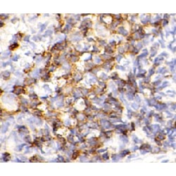 B-Cell Antigen Receptor Complex-Associated Protein Alpha Chain (CD79A) Antibody