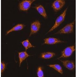 Kininogen 1 (KNG1) Antibody