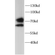 WB analysis of HepG2 cell lysates, using GUSB antibody (1/1000 dilution).